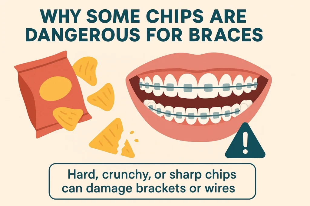 Can I Eat Chips with Braces
