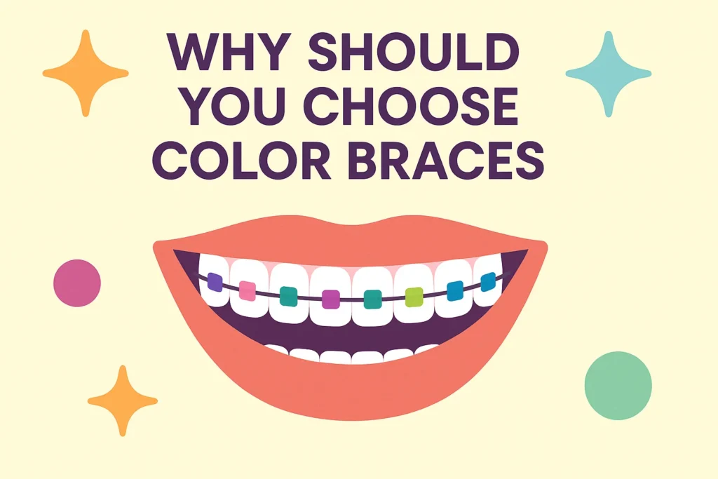 Color braces colors