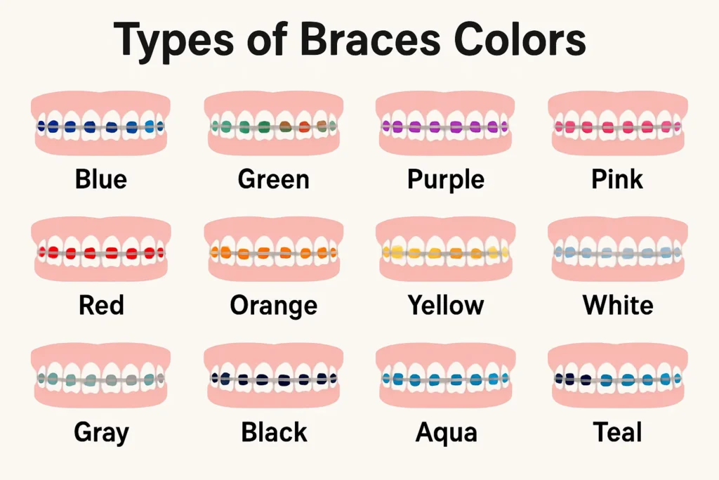 Color braces colors