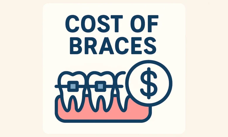 Cost of Braces