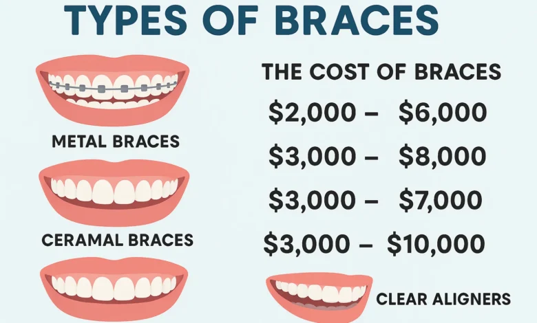 How Much Do Braces Cost