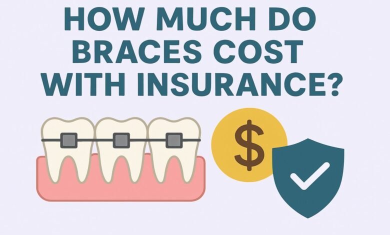 How Much Do Braces Cost With Insurance