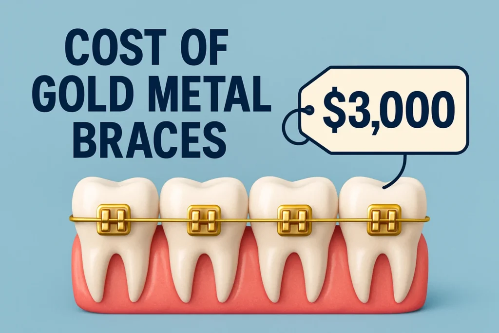 gold metal braces